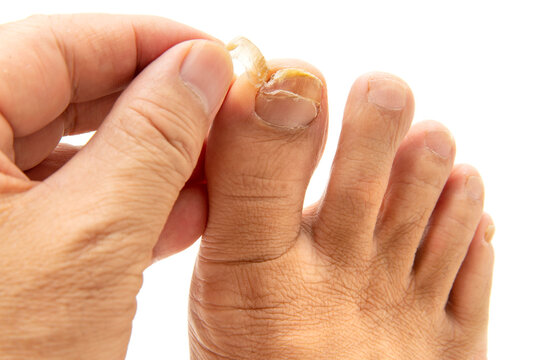 127 Best みずむし Images Stock Photos Vectors Adobe Stock