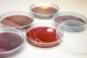 Colse-up Escherichia coli (E. coli) culture in petri dish with macconkey agar. Bacterium culture growth in glassware. Medical tests in laboratory.
