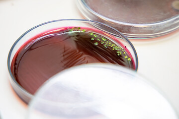 Colse-up Escherichia coli (E. coli) culture in petri dish with macconkey agar. Bacterium culture growth in glassware. Medical tests in laboratory.