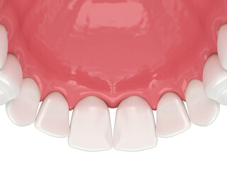 3d render of human upper jaw with black triangles © Aleksandra Gigowska