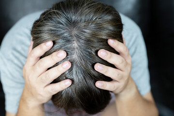 Fototapeta premium A man has hair growth, he has hair loss problems. Dry scalp, dandruff