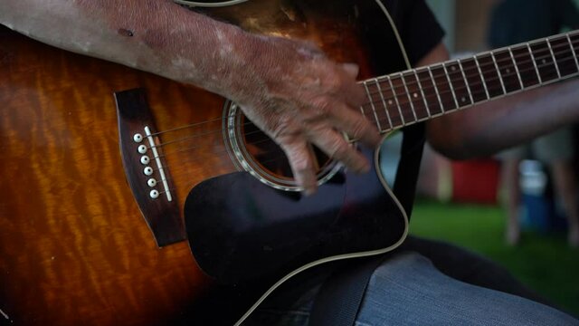 Burned victim playing guitar at a party