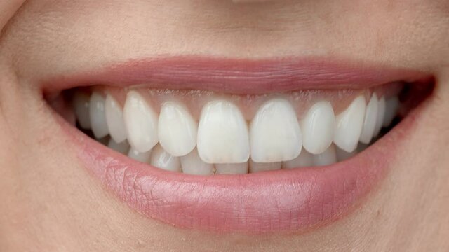 Smile of a charming girl with perfect white teeth close up. Perfect white teeth and a smile.