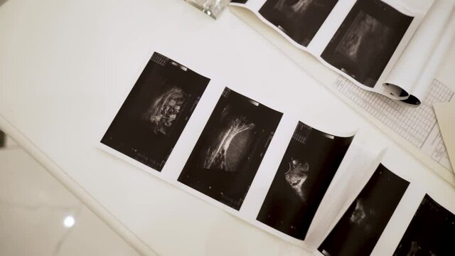 Close up of ultrasound images lying on white table background. Action. Concept of health care and medicine, black and white images of medical diagnostics.