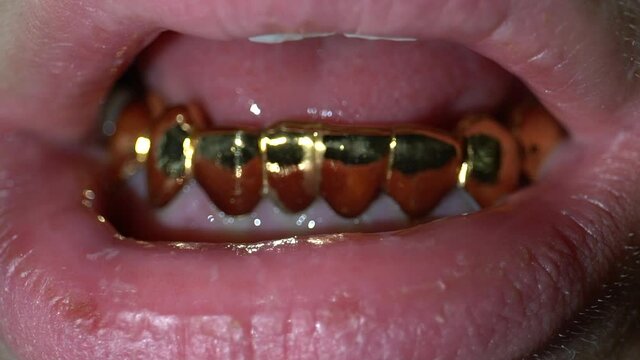Golden Grillz in a male mouth, gold teeth, lips, static