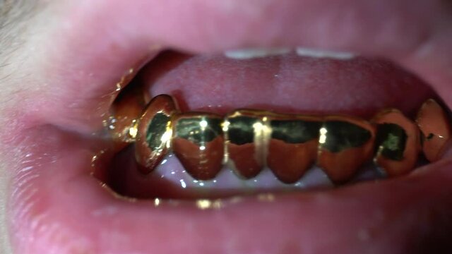 Golden Grillz in a male mouth, gold teeth, lips, right to left movement