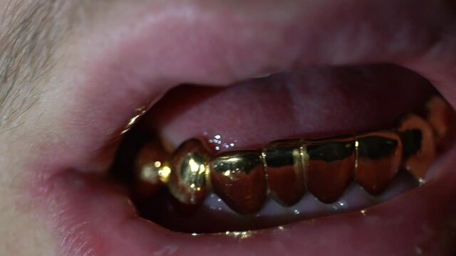 Golden Grillz in a male mouth, gold teeth, lips, left to right movement lighting
