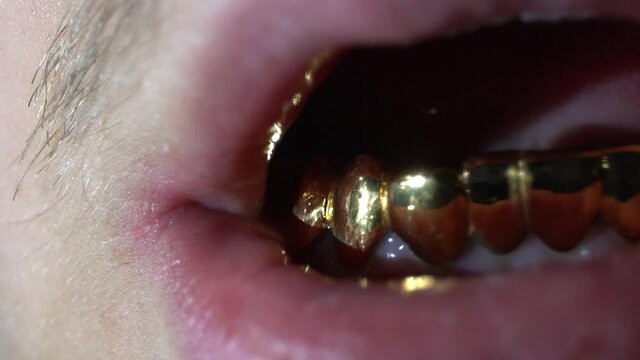 Golden Grillz in a male mouth, gold teeth, lips, lens flare