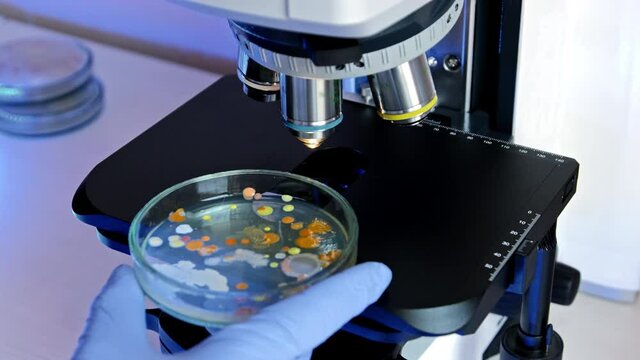 The scientist places a Petri dish with bacteria colored colonies on the microscope stage under a magnifying objective. Analysis of bacterial colonies in the laboratory.