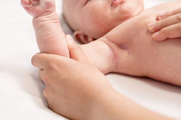 close-up of diaper rash in armpit of child