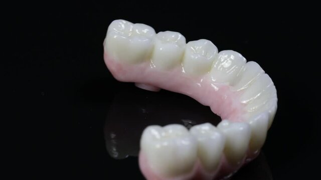 Dental health care. Close up ceramic zirconium. Dental prosthesis on zirconium oxide implants