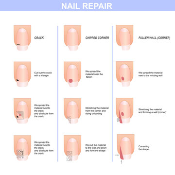 Guide to nail repair. Manicure guide, vector illustration