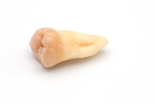 real wisdom tooth. Dental instruments for removing the tooth on the table. Bloodied torn tooth. wisdom tooth