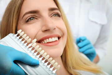Doctor matching patient's teeth color with palette, closeup. Cosmetic dentistry