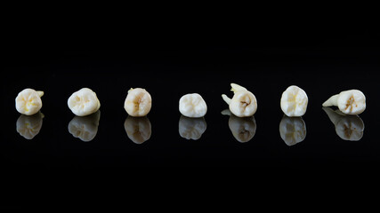 Torn human teeth stacked in a row on a black background. Close-up photo of spoiled molars and...