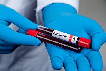 Coronavirus 2019-nCoV Blood Sample.