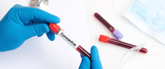 Coronavirus 2019-nCoV Blood Sample.