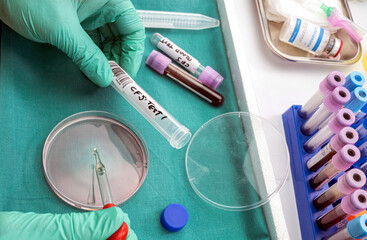 Scientific with petri-disk sampling of cerebrospinal fluid in patients with transverse myelitis...