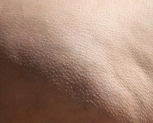 Fototapeta premium Skin with fat on the legs as an abstract background.