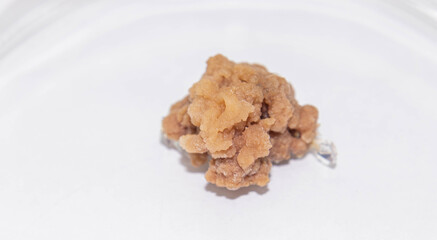 Arabidopsis (Arabidopsis thaliana, thale cress) callus tissue. 