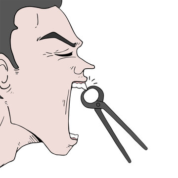 Pulling tooth with pliers illustration