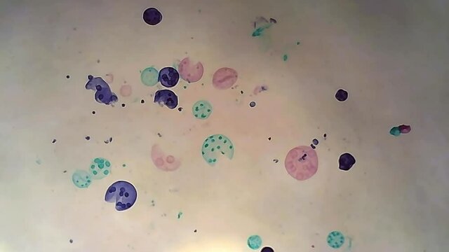 Microscope Algae Volvox 500x