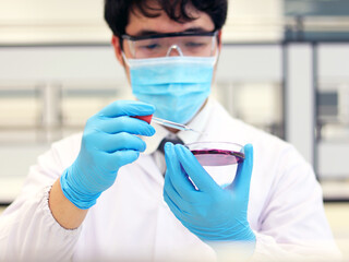 Scientist analysis Escherichia coli (E.coli) with Eosin Methylene Blue (EMB) Agar in Petri dish...