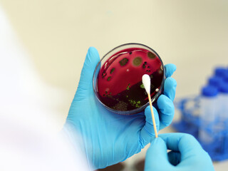 Scientist analysis Escherichia coli (E.coli) culture with Eosin Methylene Blue (EMB) Agar in Petri...