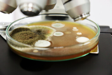 Close-up microscope examine yeasts, molds and fungal cultured with Malt Extract Agar in Petri dish...