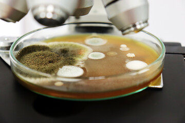 Close-up microscope examine yeasts, molds and fungal cultured with Malt Extract Agar in Petri dish use for isolating and cultivate testing from clinical samples, investigate contamination in air room.