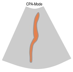 The principle of ultrasonography and the different mode of analysises and displays using for medical concern. 