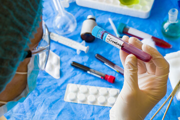 Creatinine blood test tube sample in doctors hand in laboratory