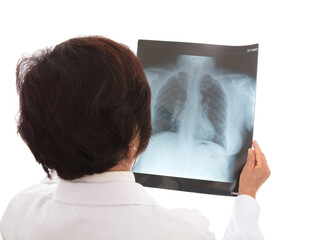 Expert doctor is examining lung X-rays