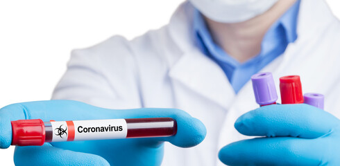 Coronavirus 2019-nCoV Blood Sample.