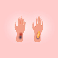 Physical injury human hand with open cut on pink background. Flat lay style. Medical adhesive plaster