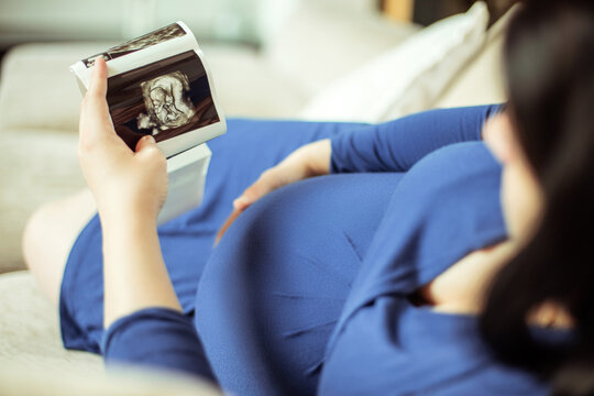 Pregnant woman holding an ultrasound picture with her baby in front of her