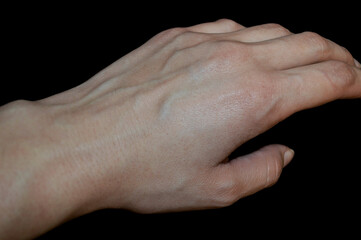 Woman hands with blood veins. Emotional gesture