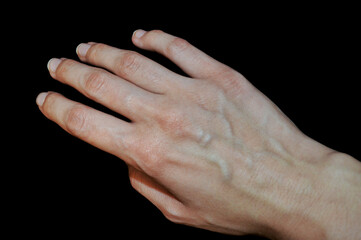 Woman hands with blood veins. Emotional gesture