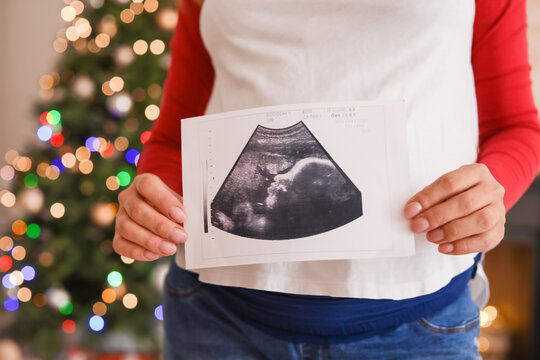 Beautiful pregnant woman with sonogram image at home on Christmas eve, closeup