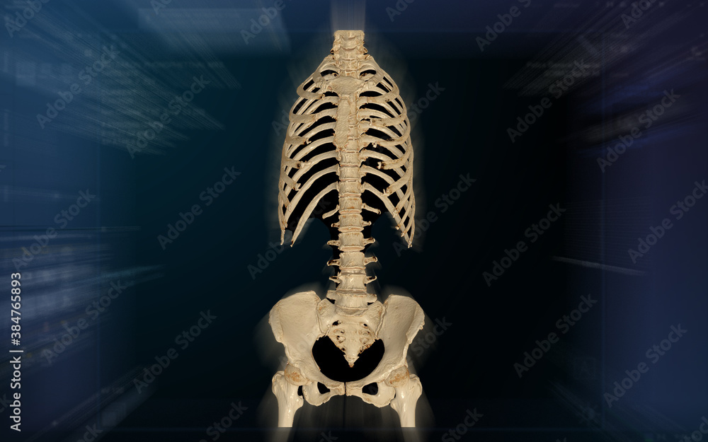 Poster ct scan of whole spine 3d rendering isolated on blurred monitor background.