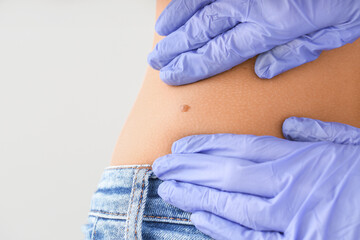 Dermatologist examining patient on light background, closeup