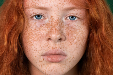 Portrait of a red-haired girl with freckles