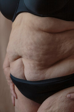 Unrecognizable mature obese woman with cellulite