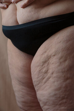 Crop overweight female with cellulite thighs