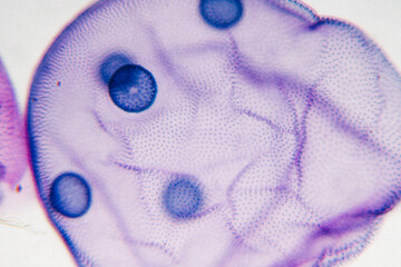 pond life volox micrograph