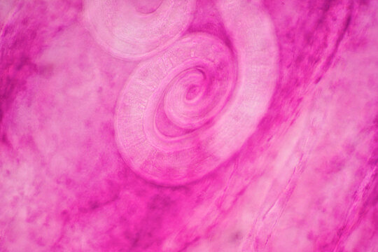 parasite Trichinella spiralis w.m
