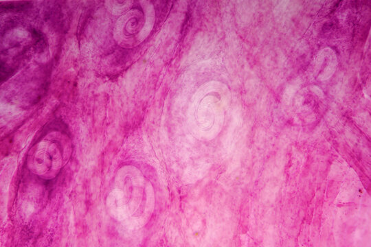 parasite Trichinella spiralis w.m