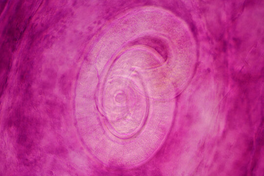 parasite Trichinella spiralis w.m