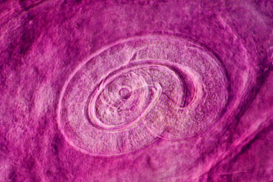 parasite Trichinella spiralis w.m