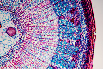 micrograph plant cells of woody dicot stem
